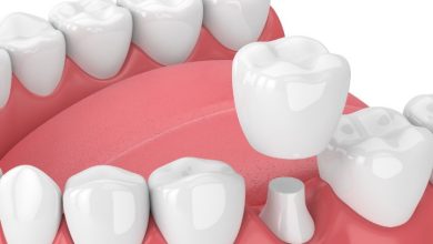 Idental crowns – benefits and possible downsides awxnews.com